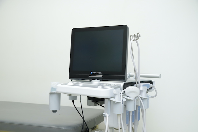 超音波診断装置